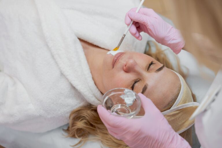 Chemical Peels to Treat Melasma in Darker Skin